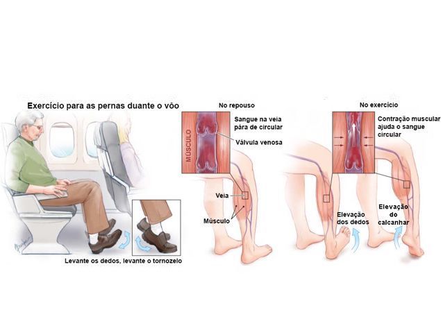 Vai viajar de avião no fim do ano? Este exercício pode prevenir uma trombose!